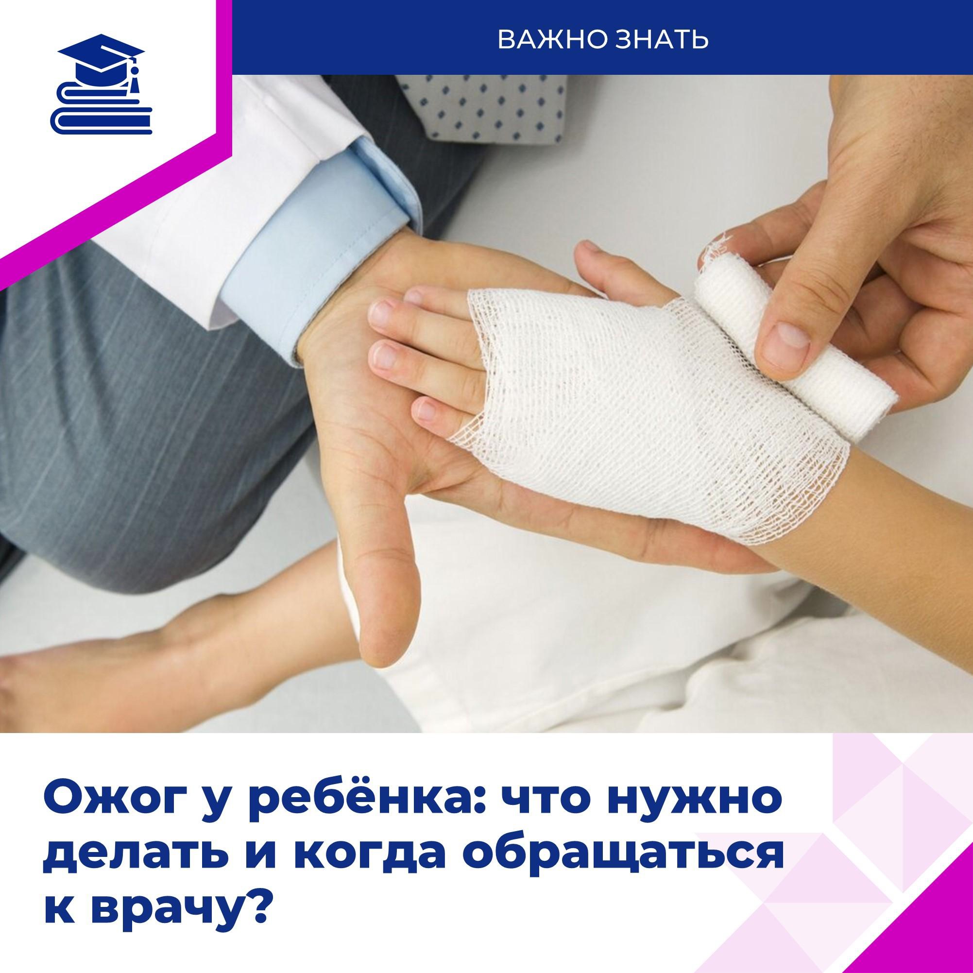 Как действовать родителям и детям при ожогах?.